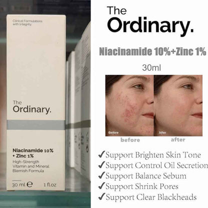 The Ordinary Skin Brightening Niacinamide 10% + Zinc 1% serum 30ml